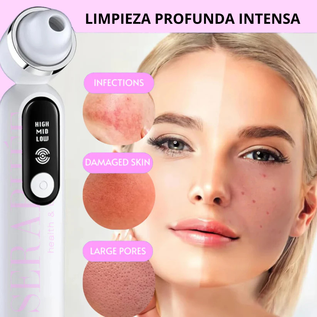 DermaLux® Extractor de Puntos Negros con Cámara HD