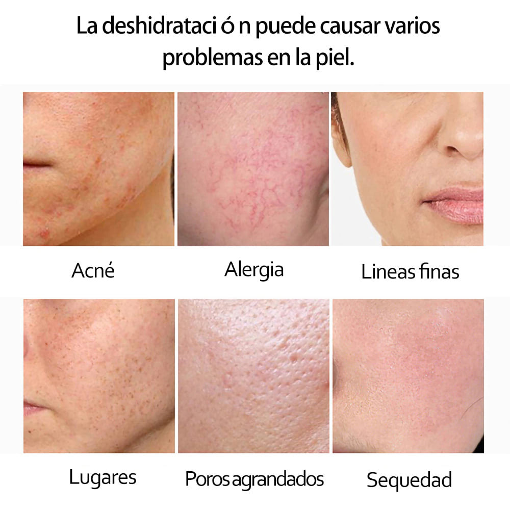 Gold Glow® Hidratación Profunda