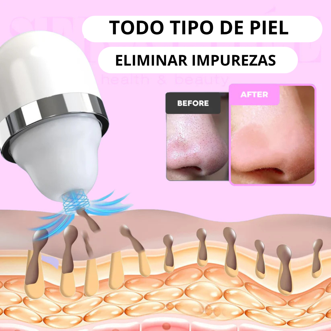DermaLux® Extractor de Puntos Negros con Cámara HD