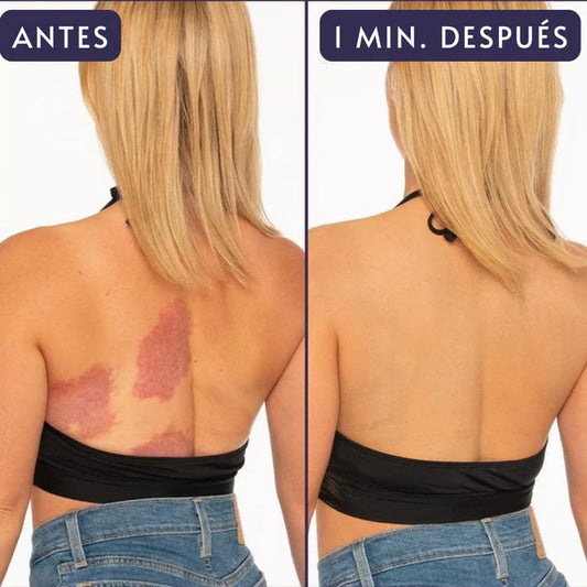 EELHOE™ - Corrector Hidratante corporal Tono Claro