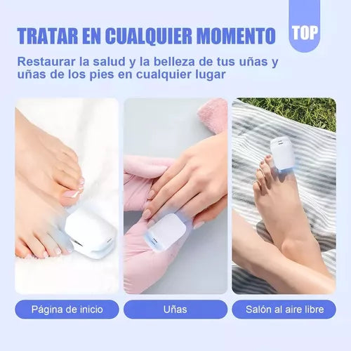 NailLux® Láser Antihongos