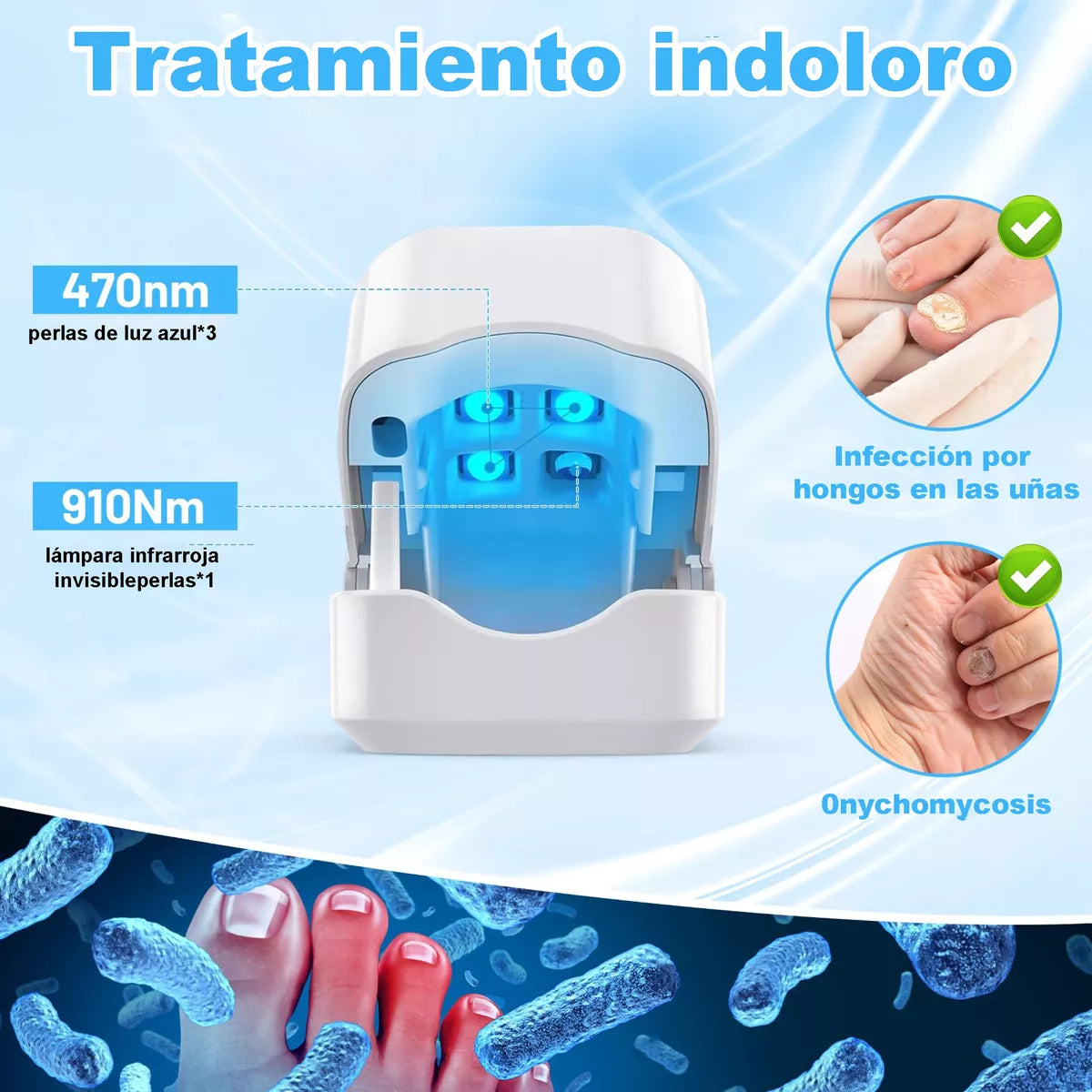 NailLux® Láser Antihongos