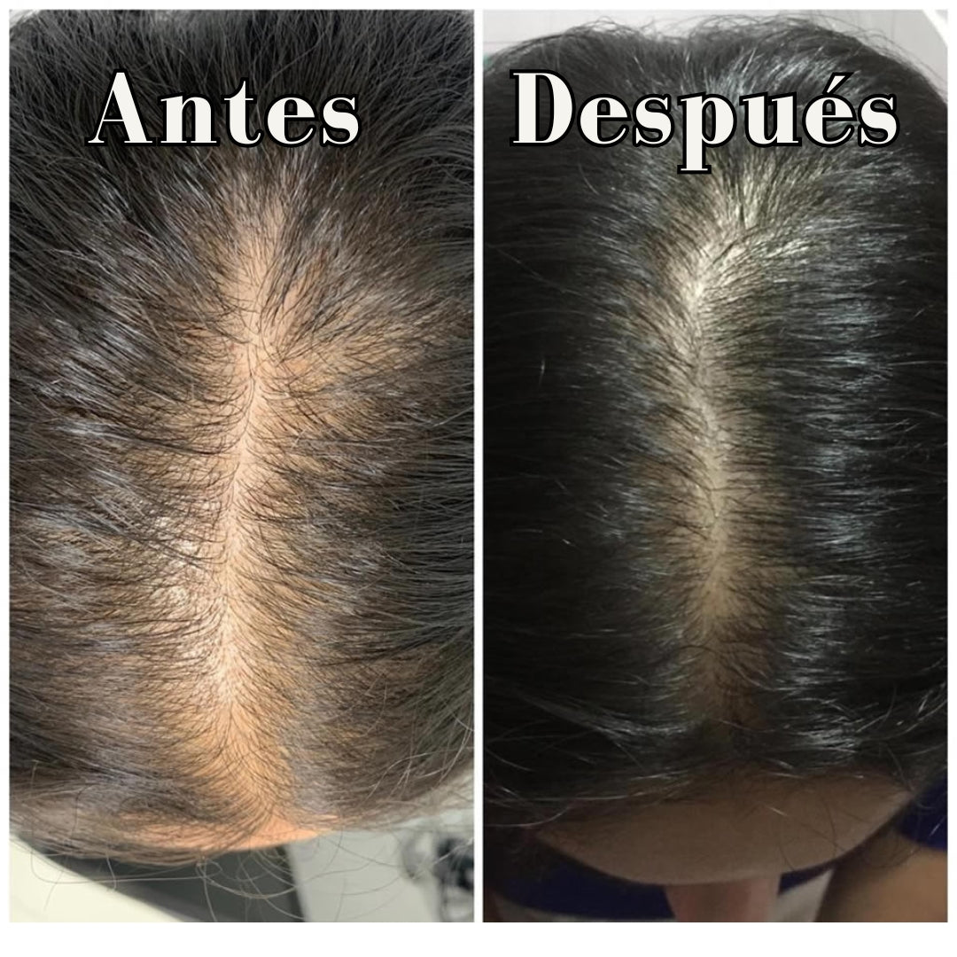 HairZen® Aceite para el Crecimiento del Cabello Unisex