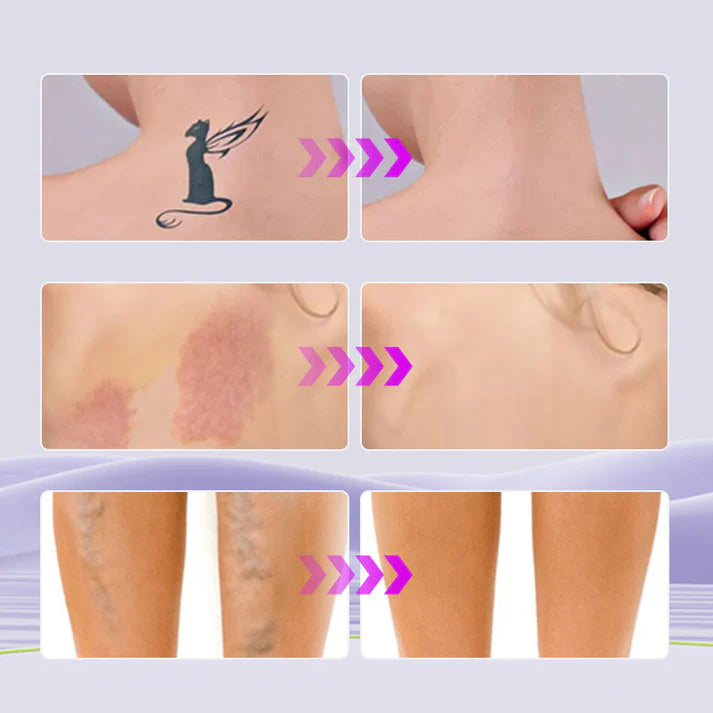 GlowDrop™ Corrector Hidratante corporal