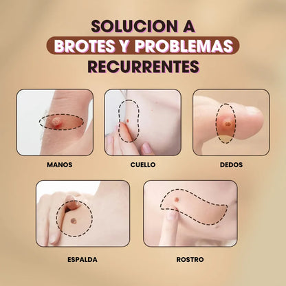 DermaErase™ Crema antiverrugas