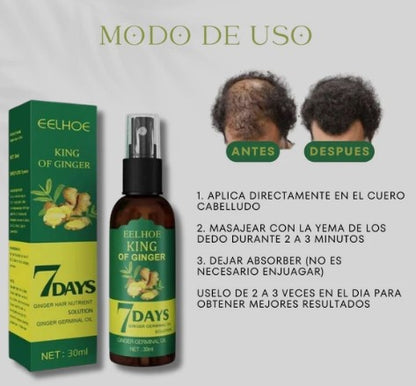 Renew® King Of Ginger-Crecimiento de cabello y barba.