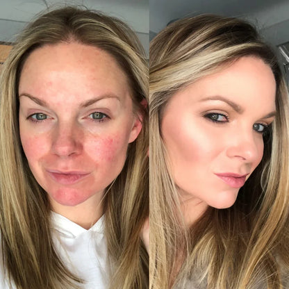 YouGlow™ Base de Piel Perfecta