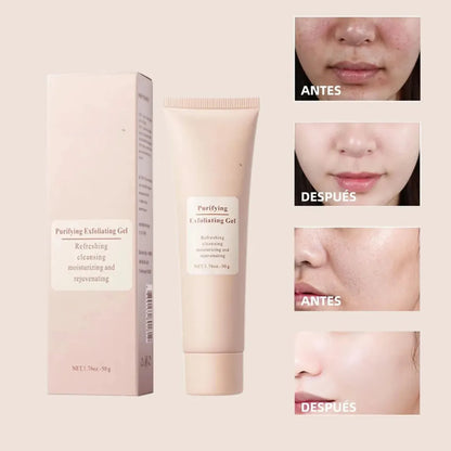 RenewPure™ Gel Exfoliante y Purificante