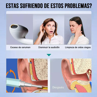 EarView® Limpiador de oidos