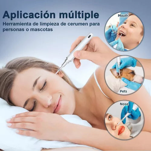 EarView® Limpiador de oidos