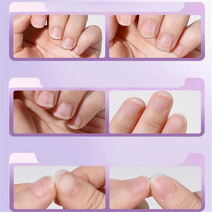 NatureNail™  Lápiz Nutritivo 3 en 1 para Uñas  (x2 unidades)