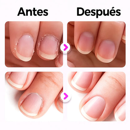 NatureNail™  Lápiz Nutritivo 3 en 1 para Uñas  (x2 unidades)